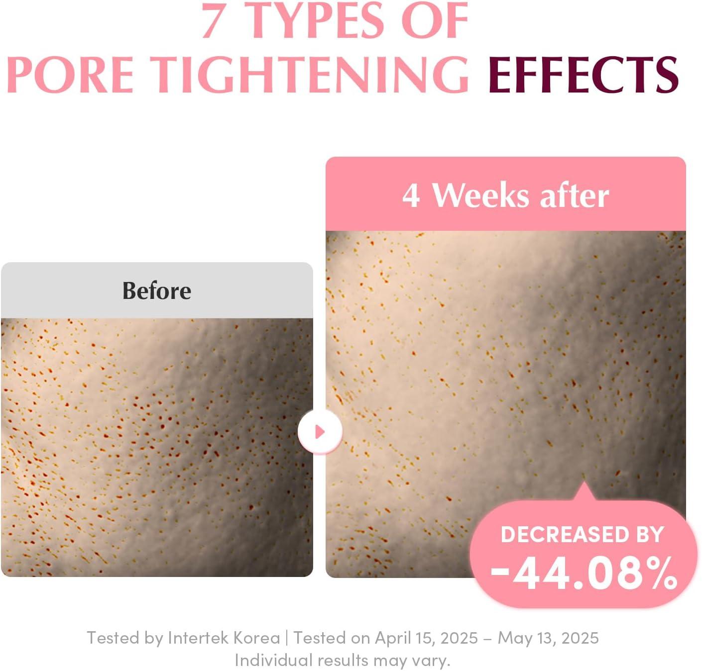 image:imageEQQUALBERRY Collagen PoreTight Up Gel Toner Pads Korean PoreTightening Jelly Pad with Deep Absorption Collagen Hydrating amp Firming Formula 473 FLOZ 140ml 60 PadsPoreTight Up