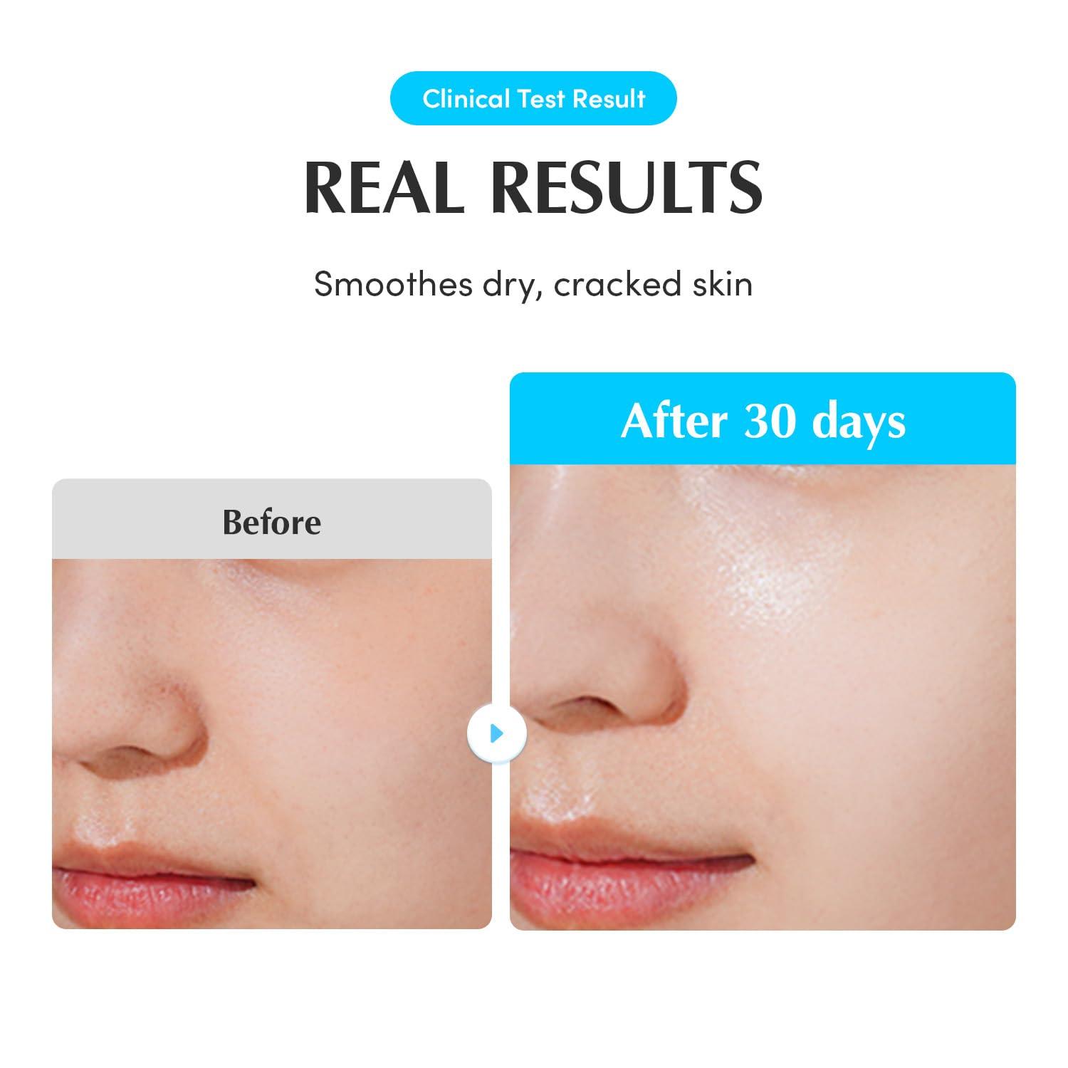image:imageEQQUALBERRY Swimming Pool Ampoule Hyaluronic Acid Serum for Glass Skin Deep Hydration and Soothing with CICA Extracts Korean Skin Care Serum 169 Fl Oz 50ml