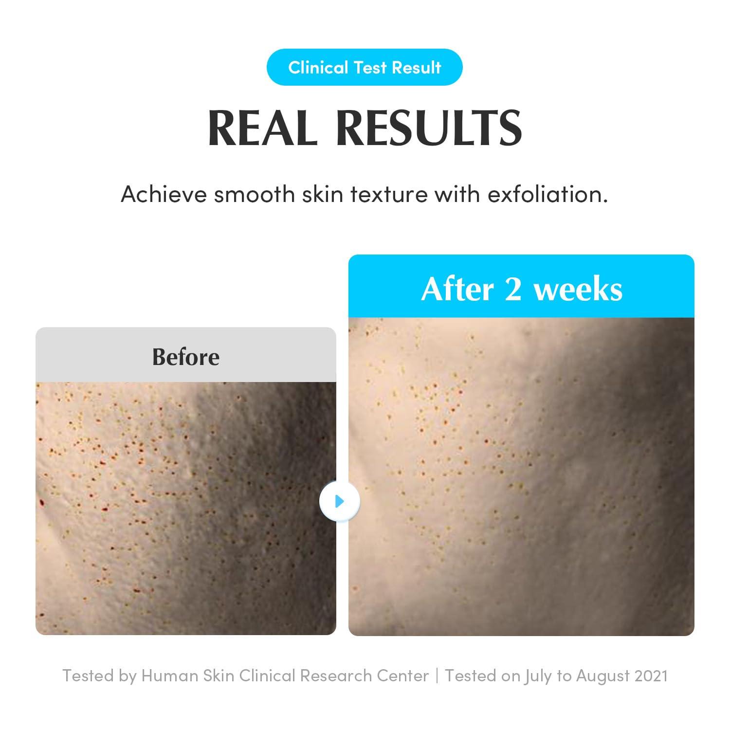 image:imageEQQUALBERRY Swimming Pool Toner Korean Toner for Daily Exfoliating amp Deep Hydration with Natural Enzyme Protease amp Hyaluronic Acid For Sensitive Skin 1014 Fl Oz 300ml
