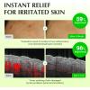 EQQUALBERRY Aloe PDRN Calming Toner, for Sensitive, | Instant Relief & Cooling | Non-Comedogenic & Fungal Acne Safe, Skin Barrier Repair | K-Beauty (5.07 fl.oz / 150ml)
