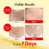 EQQUALBERRY Vitamin Illuminating Cream, Pack of 2 – Vitamin C & 5% Niacinamide + 3% TXA | Dark spots Cream | Ceramide Barrier Strength | Glowy, Lightweight Hydration (1.69 fl.oz * 2ea)(2 Pack)