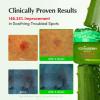 EQQUALBERRY ALOE PDRN Calming Cream | 7% Aloe PDRN & 10% Aloe Vera Water + 5-Cica | Cooling Gel Moisturizer for Oily Skin, Barrier Repair & Blemish Marks | Korean Skincare (1.69 fl.oz / 50ml)